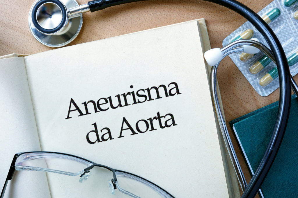 aneurisma-da-aorta Dra Nayara