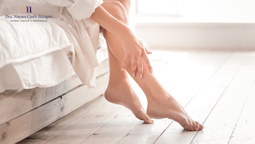 10 Dicas de Como Evitar Varizes
