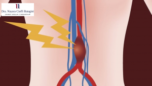 Jovens Podem Ter Aneurisma da Aorta Abdominal