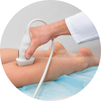 Ultrassom Doppler colorido venoso de membros inferiores