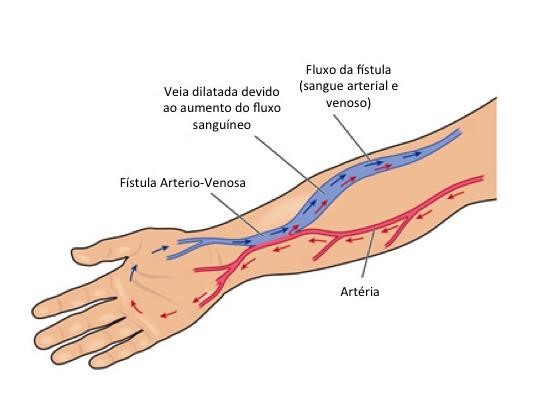 Como é realizada a cirurgia