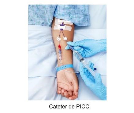PICC – Cateter de Inserção Periférica Central