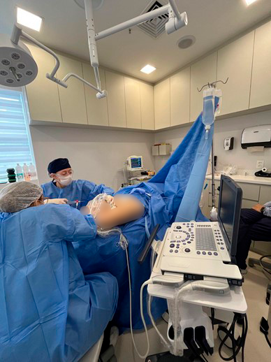 Cirurgia de Varizes Ambulatorial