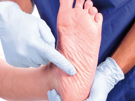 diagnostico pe diabetico